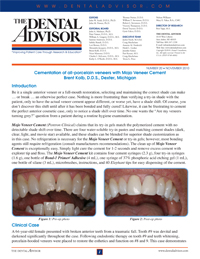 Cementation of All-porcelain Veneers with Mojo Veneer Cement – The